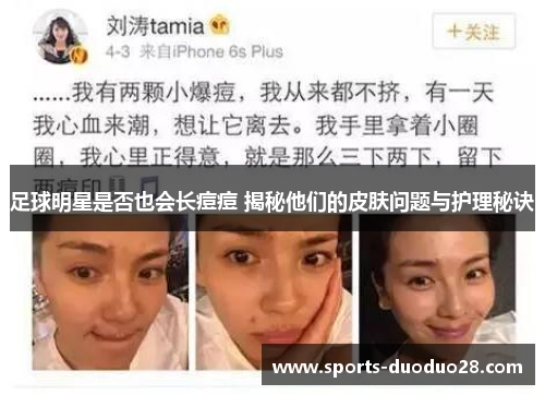 足球明星是否也会长痘痘 揭秘他们的皮肤问题与护理秘诀 足球明星是否也会长痘痘 揭秘他们的皮肤问题与护理秘诀
